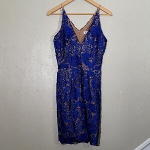 Elegant Blue Lace Dress